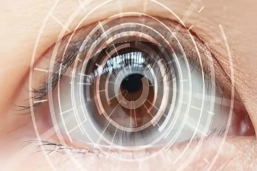 dltipic contacts lens